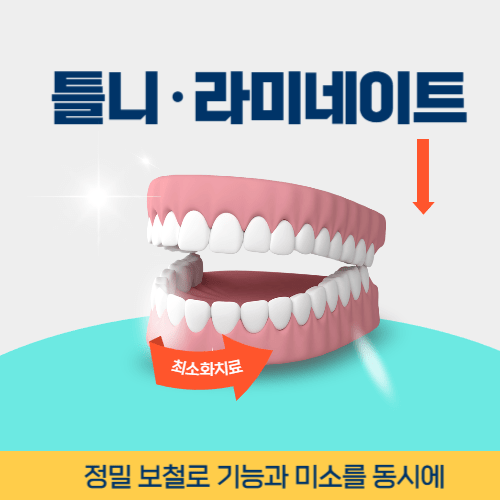 속초치과 속초시 치과 틀니 라미네이트
