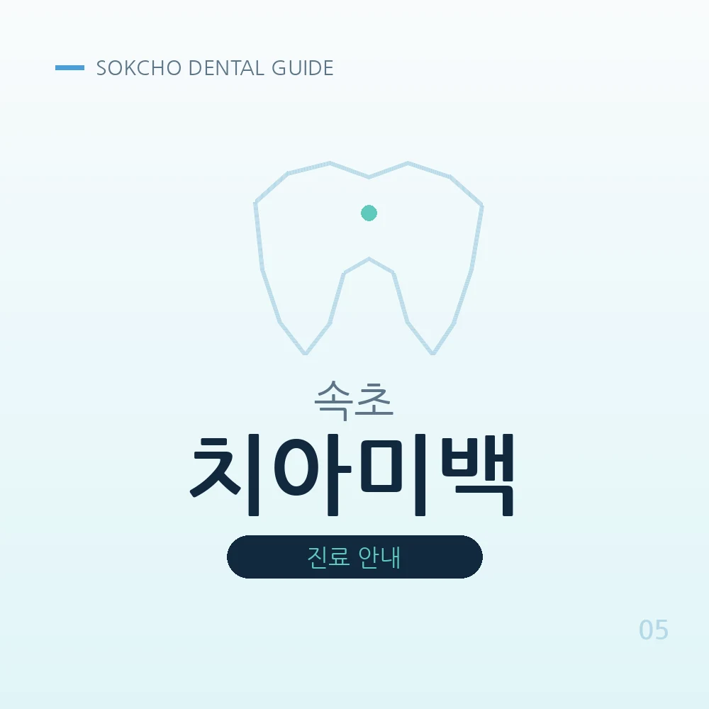 속초치아미백